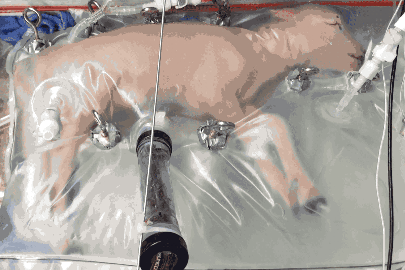 e-flux e-flux lectures: Sophie Lewis, “Wages for Womb-Work, Polymaternalism, Critical Firestonianism”
